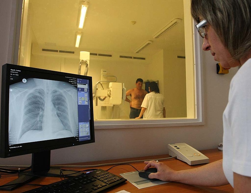 Baj van a tbc-t kimutató magyar laborokkal