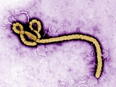 Kanadába is érkezett egy Ebola-gyanús férfi