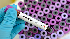 Koronavírus: ha ezt a tünetet észleli magán, szeparálja el magát!
