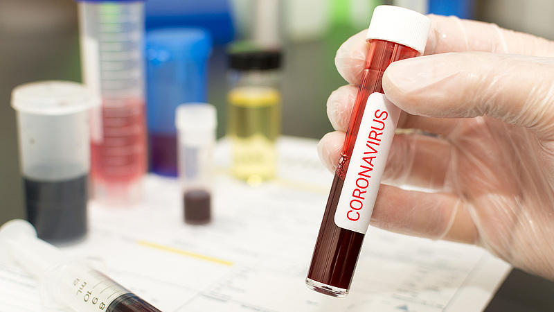 Koronavírus: mit kell tudni a laborvizsgálatokról?