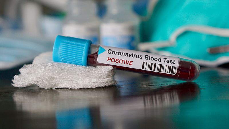 Újabb fejlesztés segíthet a koronavírus-járvány legyűrésében