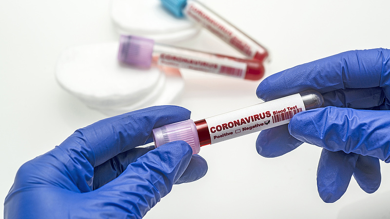 Koronavírus: ártalmasak lehetnek a gyulladáscsökkentők
