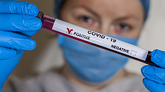 Koronavírus: ezek a friss magyar fertőzési adatok
