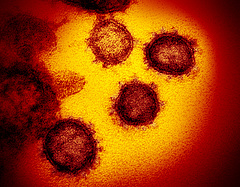 Koronavírus: a delta variáns sorra megbetegíti a beoltottakat, itt a figyelmeztetés