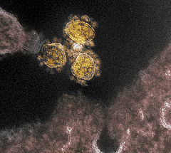Megjelent egy új, veszélyesebb tripla koronavírus-mutáció