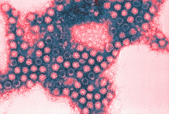 Koronavirus: az új adatok szerint 192 országban van jelen a fertőzés