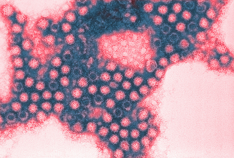 Koronavírus: 44 új fertőzött, egy halálos áldozat Magyarországon