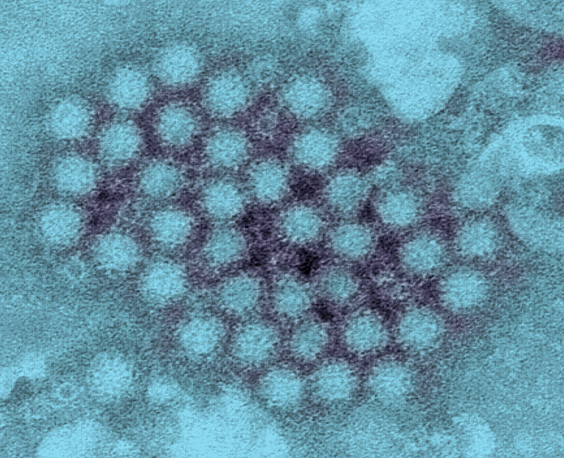A vírus nem csupán veszélyes, de aljas is