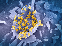 Koronavírus: megérkeztek a friss, nemzetközi adatok