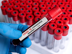 Koronavírus: egyre többen mennek ellenanyagszintet méretni