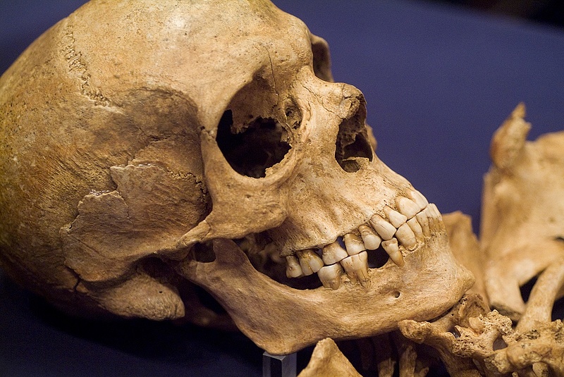 Emberi koponyát találtak egy balesetnél