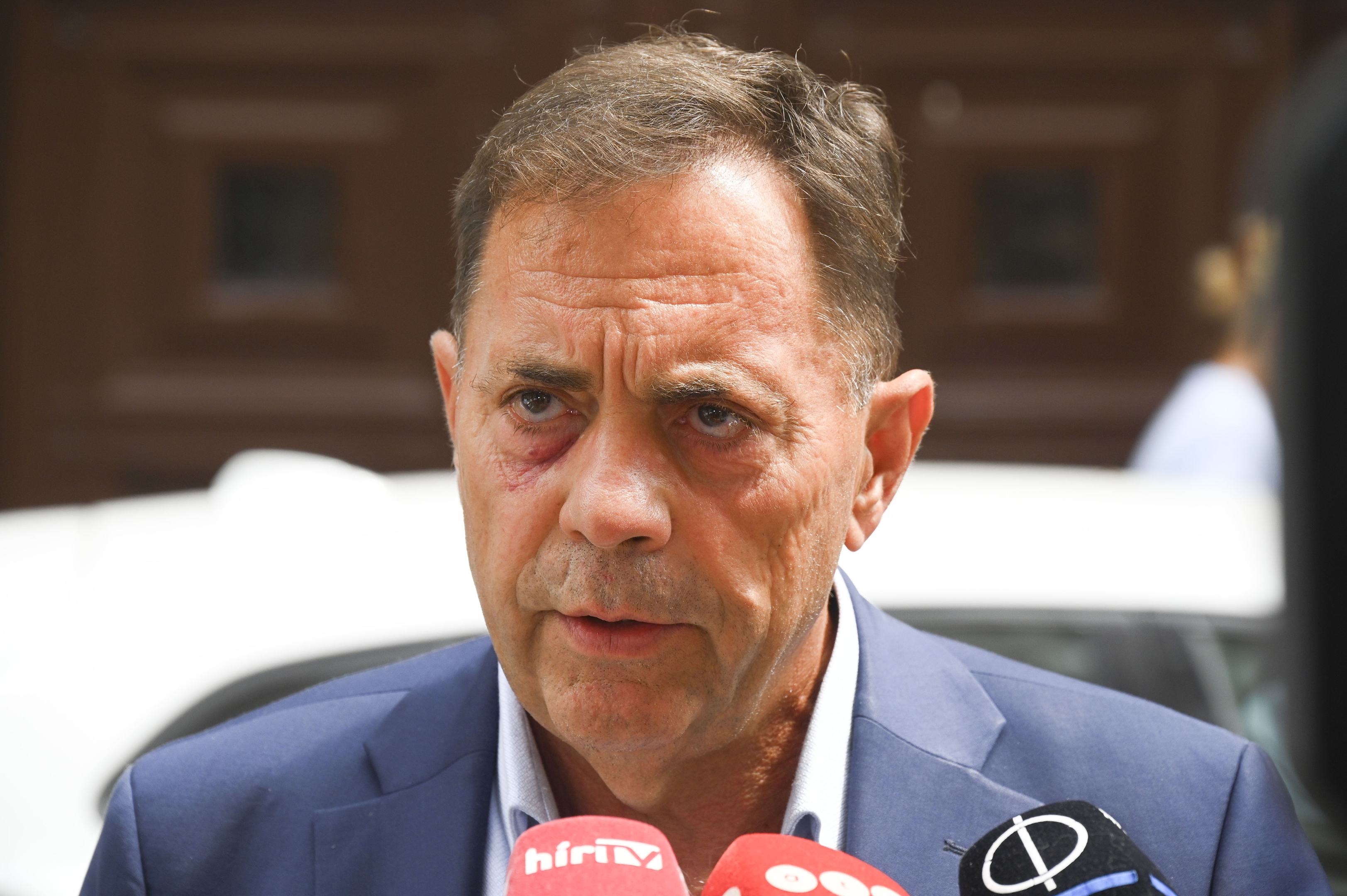 Magyar Péter kiakadt Pócs Jánoson, aki új szemüvegével videózza a képviselőket