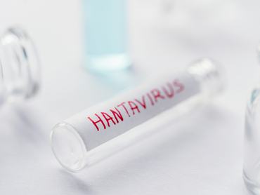 hantavírus laboratórium