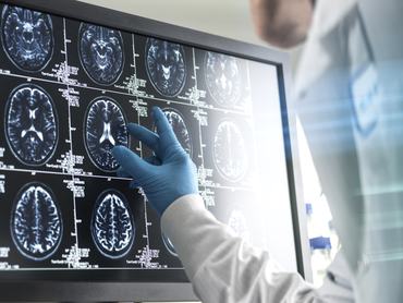 Doctor analyzing patients brain scan on screen