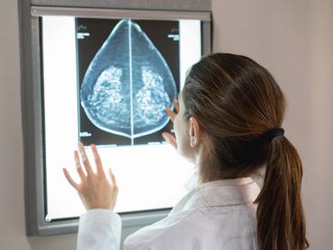 Unrecognizable female gynocologist looking at a patients mammogram at the hospital